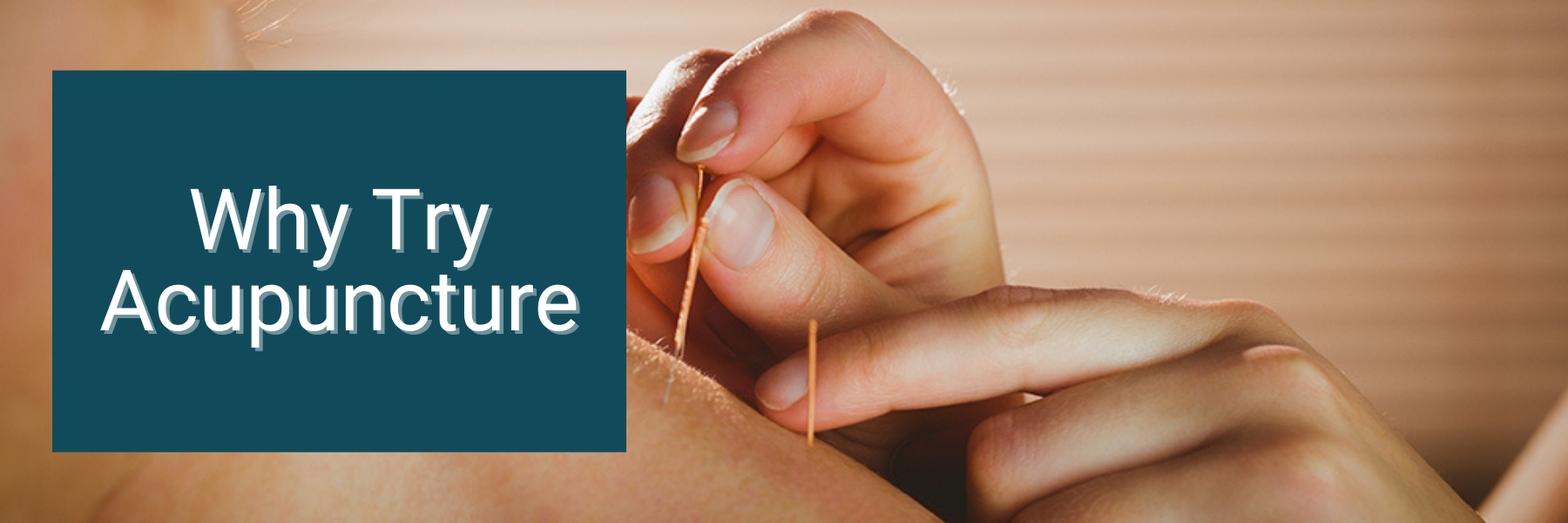 Why Try Acupuncture